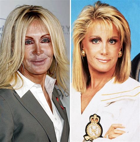 did joan van ark have plastic surgery|joan van ark plastic surgery.